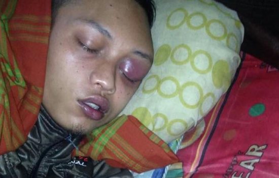 Sulit Berobat, TKI Asal Aceh Dipulangkan