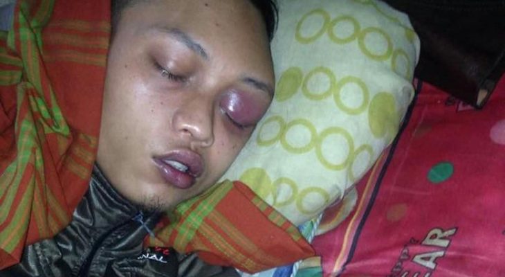 Sulit Berobat, TKI Asal Aceh Dipulangkan