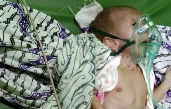 M Al-Farisi Bayi Yang Berusia 4 bulan Kondisinya Kian Memburuk