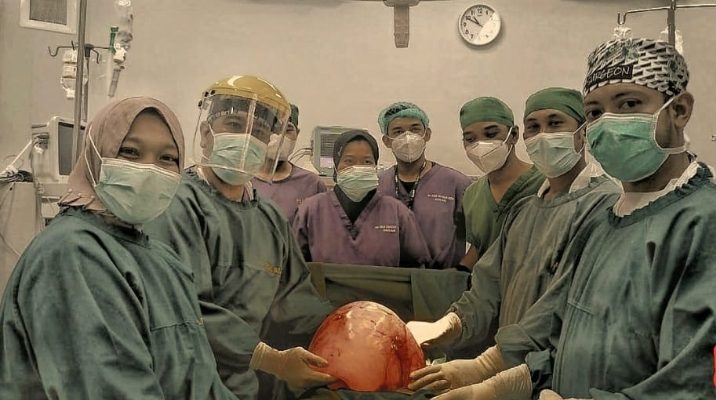 Dokter RSUD SIM Berhasil Ngangkat Tumor Ovarium