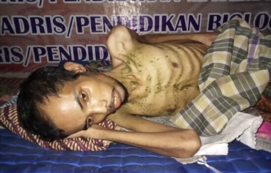 Warga Aceh Barat Terbaring Lumpuh Tidak Mampu Berobat