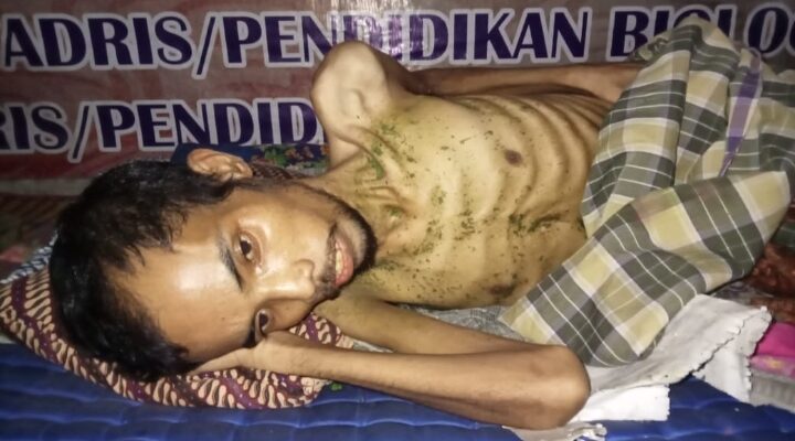 Warga Aceh Barat Terbaring Lumpuh Tidak Mampu Berobat